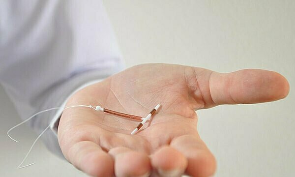 Vòng tránh thai (IUDs) có thể ngăn ngừa ung thư cổ tử cung.